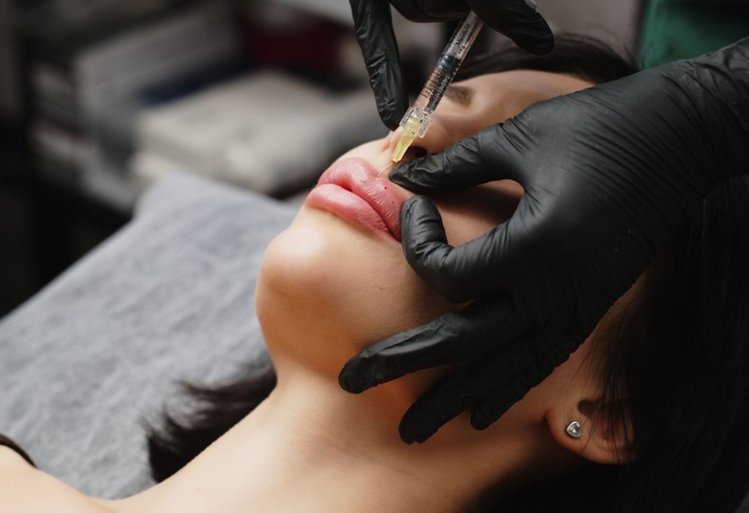 Lip Filler Training – Advanced Course - Art of Injection Academy