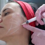 Hands-On Shadow Training for Botox and Dermal Fillers in Northern Virginia