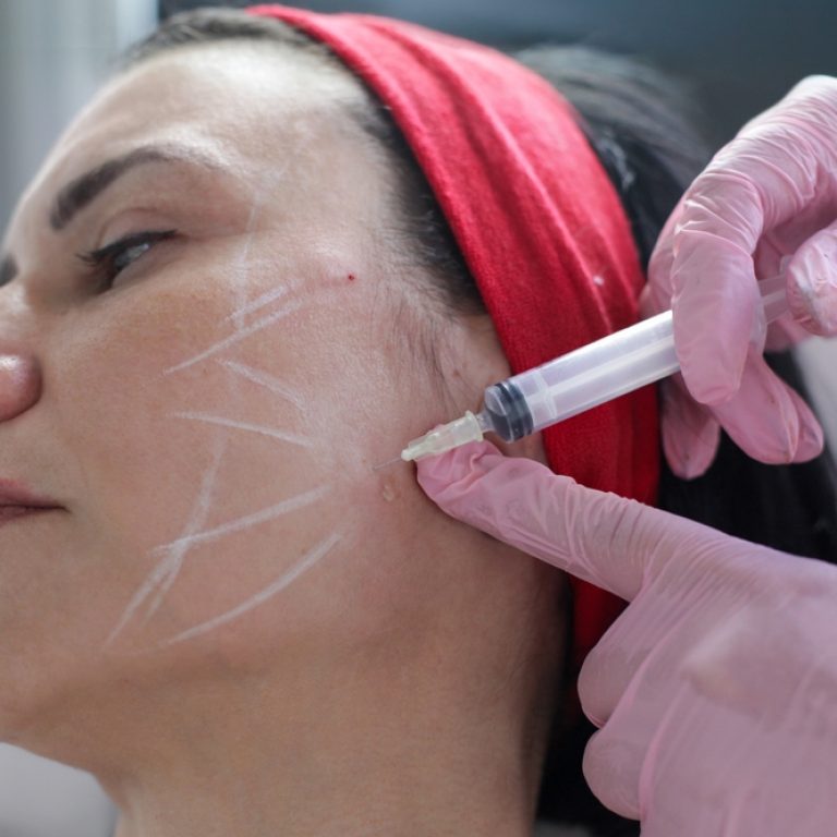 Hands-On Shadow Training for Botox and Dermal Fillers in Northern Virginia